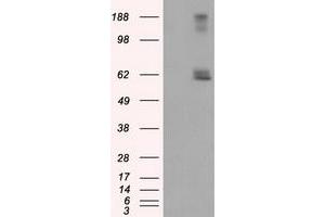 HEK293T cells were transfected with the pCMV6-ENTRY control (Left lane) or pCMV6-ENTRY LIPG (Right lane) cDNA for 48 hrs and lysed. (LIPG antibody)