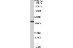 ABIN4902651 (0. (Hydroxyacid Oxidase 2 (HAO2) antibody)