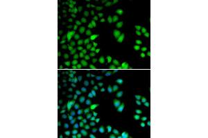 Immunofluorescence analysis of HeLa cells using RPS6KA3 antibody (ABIN5973157).