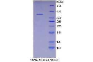 SDS-PAGE (SDS) image for Osteocalcin (BGLAP) (AA 21-99) protein (His tag,GST tag) (ABIN2123427)