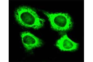 Immunofluorescence of HeLa cell line with WARS polyclonal antibody .
