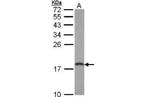 WB Image Sample (30 ug of whole cell lysate) A: Hep G2 , 12% SDS PAGE antibody diluted at 1:1000 (PFDN5 antibody)