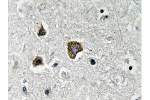 Immunohistochemistry analyzes of BNIP-3 antibody in paraffin-embedded human brain tissue. (BNIP3 antibody)