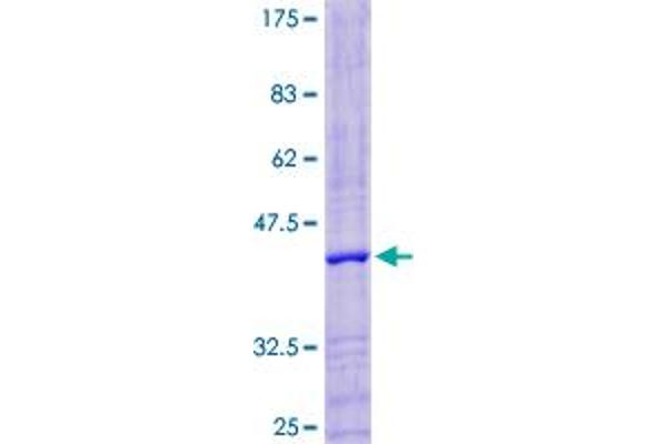 Lysozyme-Like 4 Protein (LYZL4) (AA 1-146) (GST tag)