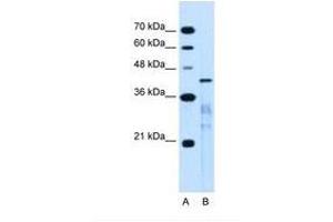 Image no. 2 for anti-MARVEL Domain Containing 3 (MARVELD3) (AA 219-268) antibody (ABIN6739457) (MARVELD3 antibody  (AA 219-268))