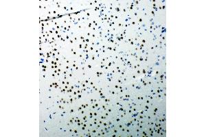 Anti-53BP1 antibody, IHC(P) IHC(P): Rat Brain Tissue (TP53BP1 antibody  (C-Term))