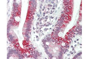 Human Small Intestine: Formalin-Fixed, Paraffin-Embedded (FFPE).