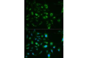 Immunofluorescence analysis of MCF-7 cells using TLR8 antibody (ABIN6291882).