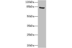 Western blot All lanes: NOL10 antibody at 8 μg/mL + K562 whole cell lysate Secondary Goat polyclonal to rabbit IgG at 1/10000 dilution Predicted band size: 81, 75, 22, 78 kDa Observed band size: 81 kDa (Nucleolar Protein 1 (NOL1) (AA 1-210) antibody)