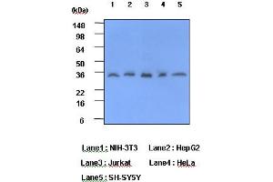 Western Blotting (WB) image for anti-C-Reactive Protein (CRP) antibody (ABIN361037) (CRP antibody)