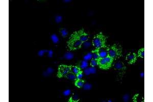 Anti-ACO2 mouse monoclonal antibody (ABIN2452697) immunofluorescent staining of COS7 cells transiently transfected by pCMV6-ENTRY ACO2 (RC204307). (ACO2 antibody)