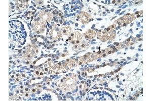 IGSF1 antibody was used for immunohistochemistry at a concentration of 4-8 ug/ml to stain Epithelial cells of renal tubule (arrows) in Human Kidney. (IGSF1 antibody  (N-Term))