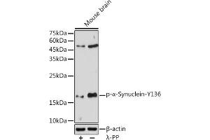 Western blot analysis of extracts of Mouse brain, using Phospho-α-Synuclein-Y136 antibody (ABIN3019943, ABIN3019944, ABIN3019945, ABIN1682064 and ABIN1682065) at 1:1000 dilution. (SNCA antibody  (pTyr136))