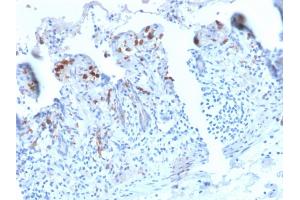 Formalin-fixed, paraffin-embedded human Small Intestine stained with CD209 Recombinant Rabbit Monoclonal Antibody (C209/2749R). (Recombinant DC-SIGN/CD209 antibody)