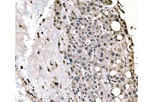 IHC analysis of splicing factor 1 using anti-splicing factor 1 antibody (ABIN7600194). (Splicing Factor 1 antibody  (AA 160-266))