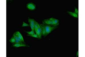 Immunofluorescent analysis of Hela cells using ABIN7157989 at dilution of 1:100 and Alexa Fluor 488-congugated AffiniPure Goat Anti-Rabbit IgG(H+L)