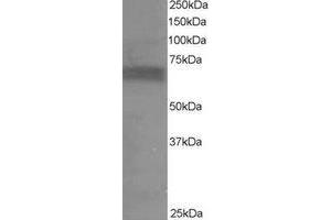 Western Blotting (WB) image for anti-Ribosomal Protein S6 Kinase, 70kDa, Polypeptide 1 (RPS6KB1) (C-Term) antibody (ABIN2465296) (RPS6KB1 antibody  (C-Term))