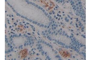Immunohistochemistry (IHC) image for anti-Signal Transducer and Activator of Transcription 2, 113kDa (STAT2) (AA 616-849) antibody (ABIN7434083)