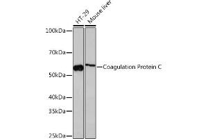 Western blot analysis of extracts of various cell lines, using Coagulation Coagulation Protein C Rabbit mAb (ABIN7271333) at 1:1000 dilution. (PROC antibody)