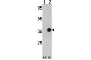 Western blot analysis of NPM1 (arrow) using rabbit polyclonal NPM1 Antibody (C-term) .