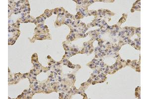 Immunohistochemistry (IHC) image for anti-Heat Shock 70kDa Protein 8 (HSPA8) antibody (ABIN1873101) (Hsc70 antibody)