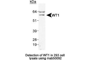 Image no. 1 for anti-Wilms Tumor 1 (WT1) (AA 1-181) antibody (ABIN363246) (WT1 antibody  (AA 1-181))