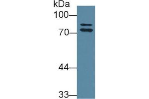 Western Blot; Sample: Rat Liver lysate; Primary Ab: 1µg/ml Rabbit Anti-Rat OS9 Antibody Second Ab: 0. (OS9 antibody  (AA 465-666))