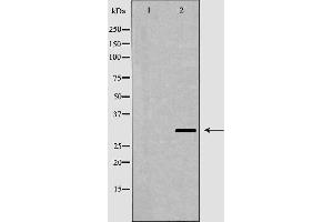 Western blot analysis of brain  using APOA1 antibody. (APOA1 antibody  (N-Term))