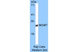 Image no. 1 for anti-O6-Methylguanine-DNA-Methyltransferase (MGMT) (AA 8-221) antibody (ABIN6560107) (MGMT antibody  (AA 8-221))