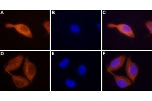 Expression of STIM2 in RBL cells - Immunocytochemical staining of paraformaldehyde-fixed and permeabilized rat basophilic leukemia (RBL) cells. (Stim2 antibody  (C-Term, Intracellular))