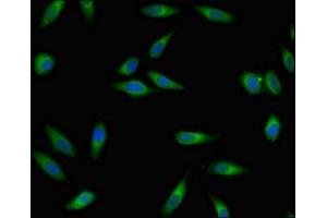 Immunofluorescent analysis of Hela cells using ABIN7167611 at dilution of 1:100 and Alexa Fluor 488-congugated AffiniPure Goat Anti-Rabbit IgG(H+L) (RGS4 antibody  (AA 1-205))