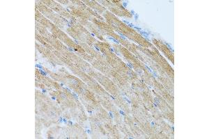 Immunohistochemistry of paraffin-embedded mouse heart using CCL2 antibody (ABIN4903158) at dilution of 1:100 (40x lens). (CCL2 antibody)