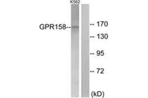 Western blot analysis of extracts from K562 cells, using GPR158 Antibody.