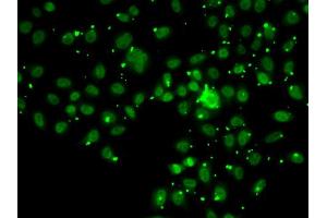 Immunofluorescence analysis of A549 cell using ATRIP antibody. (ATRIP antibody)