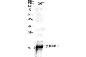 Western Blotting (WB) image for anti-Synuclein, alpha (SNCA) (Tyr1112) antibody (ABIN3177574) (SNCA antibody  (Tyr1112))