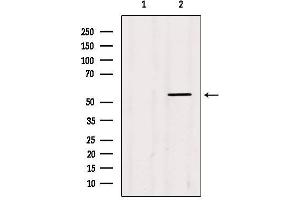 Western blot analysis of extracts from HepG2, using Akt Antibody.