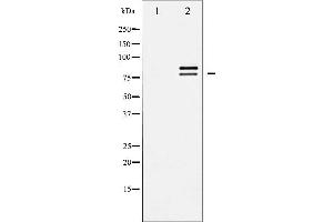 Western blot analysis of HSL expression in CalyculinA treated HeLa whole cell lysates,The lane on the left is treated with the antigen-specific peptide. (LIPE antibody  (Internal Region))