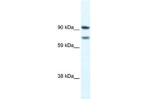 WB Suggested Anti-ZFHX1B Antibody Titration: 0. (ZEB2 antibody  (N-Term))