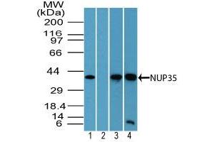 Image no. 2 for anti-Nucleoporin 35kDa (NUP35) (AA 280-330) antibody (ABIN960296) (NUP35 antibody  (AA 280-330))
