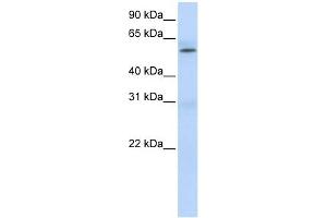PRMT3 antibody used at 1 ug/ml to detect target protein. (PRMT3 antibody  (Middle Region))
