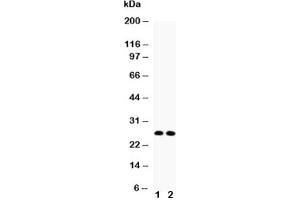 Western blot testing of VEGF antibody (A isoform) and Lane 1:  rat thymus;  2: rat brain lysate (VEGFA antibody  (AA 27-191))