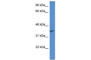 WB Suggested Anti-SORD AntibodyTitration: 1. (SORD antibody  (N-Term))