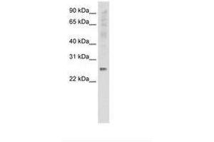 Image no. 1 for anti-Synaptosomal-Associated Protein, 25kDa (SNAP25) (C-Term) antibody (ABIN6736141) (SNAP25 antibody  (C-Term))