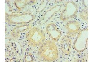 Immunohistochemistry of paraffin-embedded human kidney tissue using ABIN7143467 at dilution of 1:100 (GGA2 antibody  (AA 1-300))