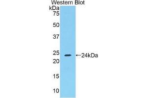 Western blot analysis of the recombinant protein. (FGA antibody  (AA 357-556))