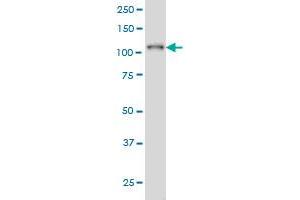 PTK2B monoclonal antibody (M02A), clone 3G2 Western Blot analysis of PTK2B expression in K-562 (  ). (PTK2B antibody  (AA 682-871))