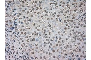 Image no. 1 for anti-Cancer/testis Antigen 1B (CTAG1B) antibody (ABIN1499899) (CTAG1B antibody)