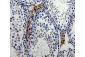 IHC-P analysis of Testis tissue, with DAB staining. (IL-21 antibody  (AA 25-146))