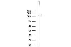 Western blot analysis of lysates from COLO205 cells, using Phospho-Dab1 (Tyr220) Antibody at 1/1000 dilution.