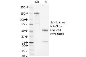 SDS-PAGE Analysis Purified CD1b Mouse Monoclonal Antibody (RIV12). (CD1b antibody)